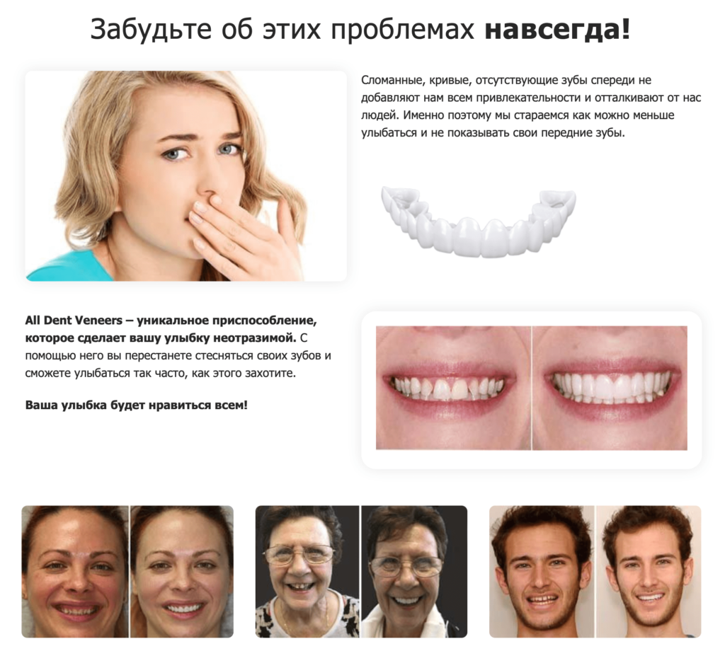 Преимущества ALL DENT VENEERS