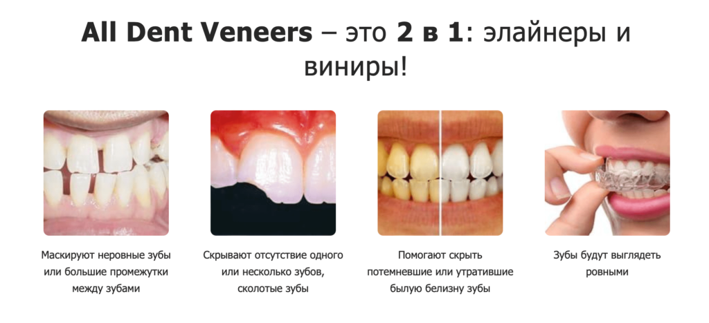 Какие проблемы решают съемные виниры ALL DENT VENEERS?